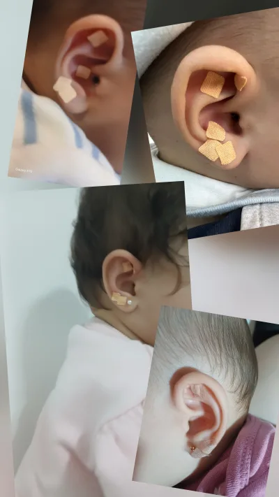 Auriculoterapeuta