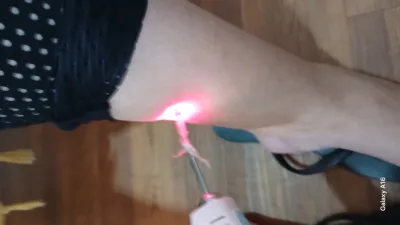 Laserterapia