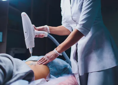 Consulta Remoção de tatuagem e micropigmentos